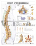 Human Spine Disorders Anatomical Chart